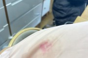 手机摄像头上的胶液如何清除？