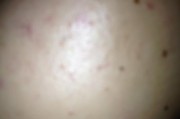 充电器上的黑点如何去除？是否影响使用？