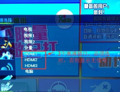 电视机设置默认网关的方法是什么？