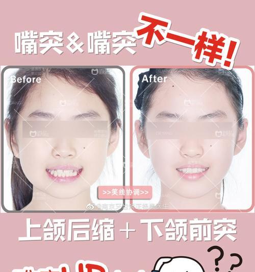 畸形摄像头手机如何使用视频功能？操作复杂吗？