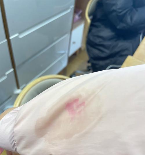 手机摄像头上的胶液如何清除？